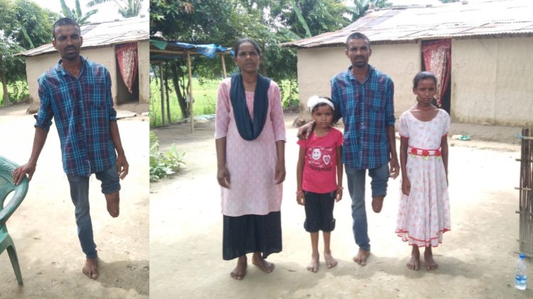 সামাজিক মাধ্যমৰ প্ৰচাৰেই পৰিবৰ্তন আনিলে বোকাখাতৰ বিকি বৰাইকৰ জীৱনলৈ  :  বোকাখাতৰ সাংবাদিকৰ উদ্যোগত কৃত্ৰিম অংগ সংস্থাপনেৰে এতিয়া লাভ কৰিব নতুন জীৱন  :