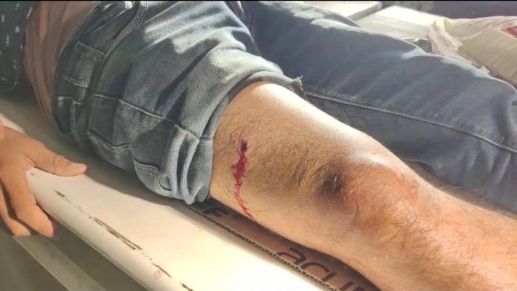 বোকাখাতত দিন দুপৰতে মটৰ চাইকেল আৰোহীক গুলীয়াই মটৰচাইকেল লৈ উধাও দুৰ্বৃত্ত  : এটা দিনতে দুখনকৈ মটৰচাইকেল লৈ যোৱাৰ পিচত অসহায় আৰক্ষী  :